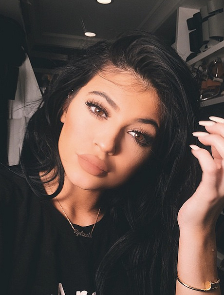 Kylie Jenner’s Lips Gone Horribly Wrong